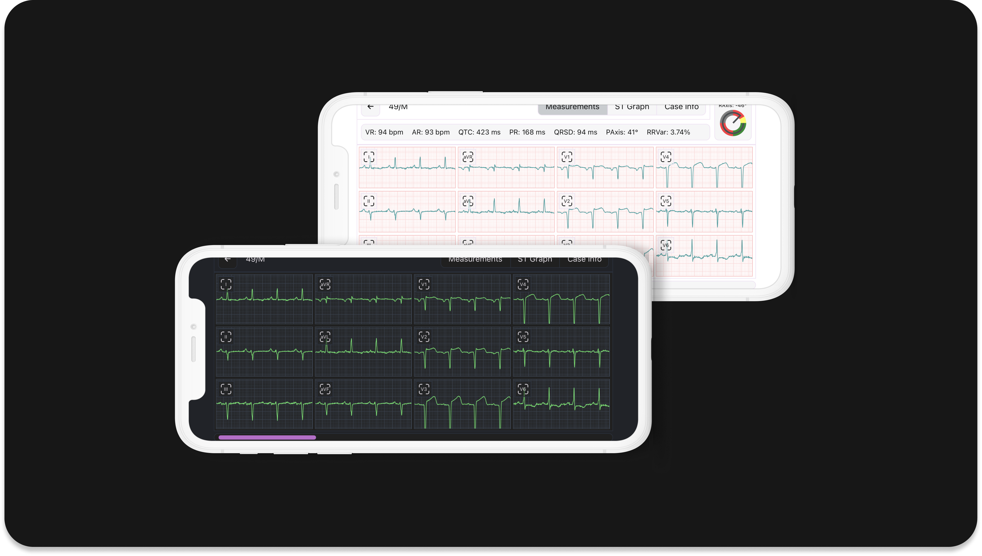 ECG Viewer
